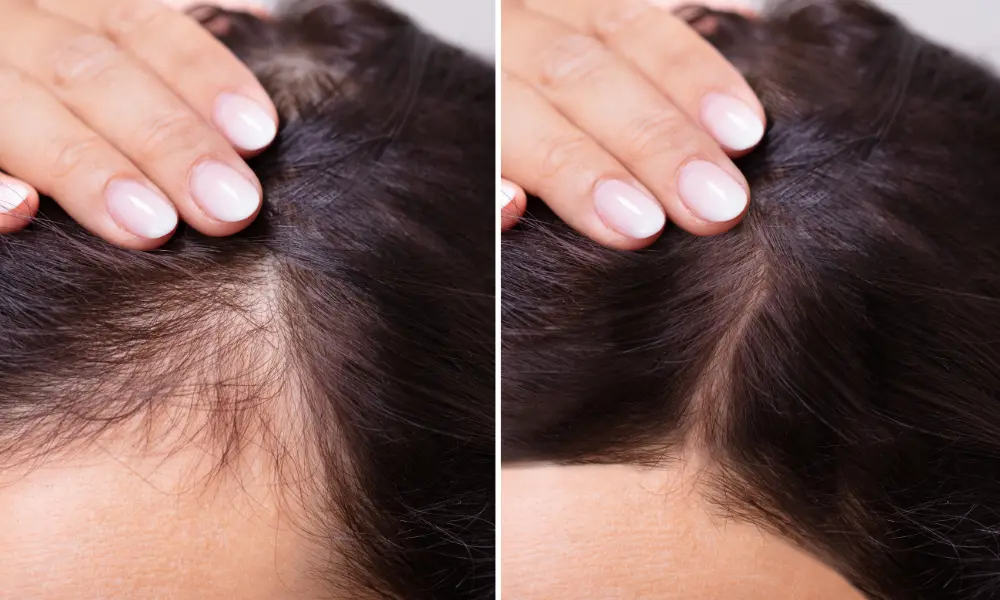 before after (3)