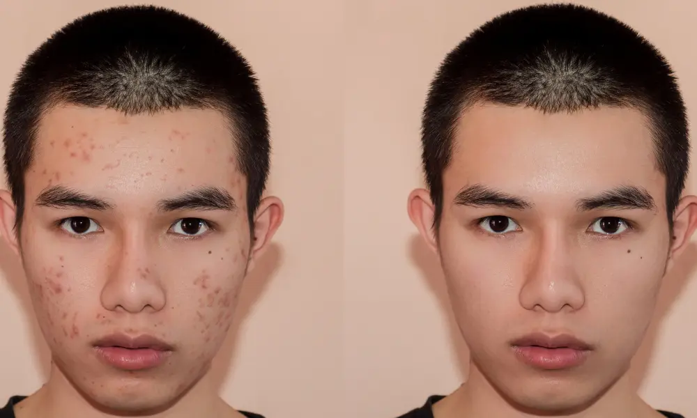 before after (5)