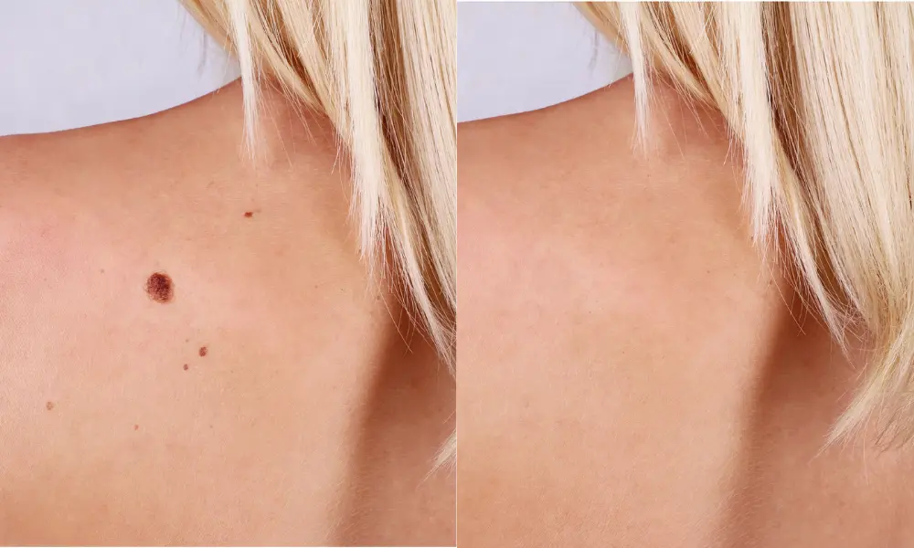 before after (6)